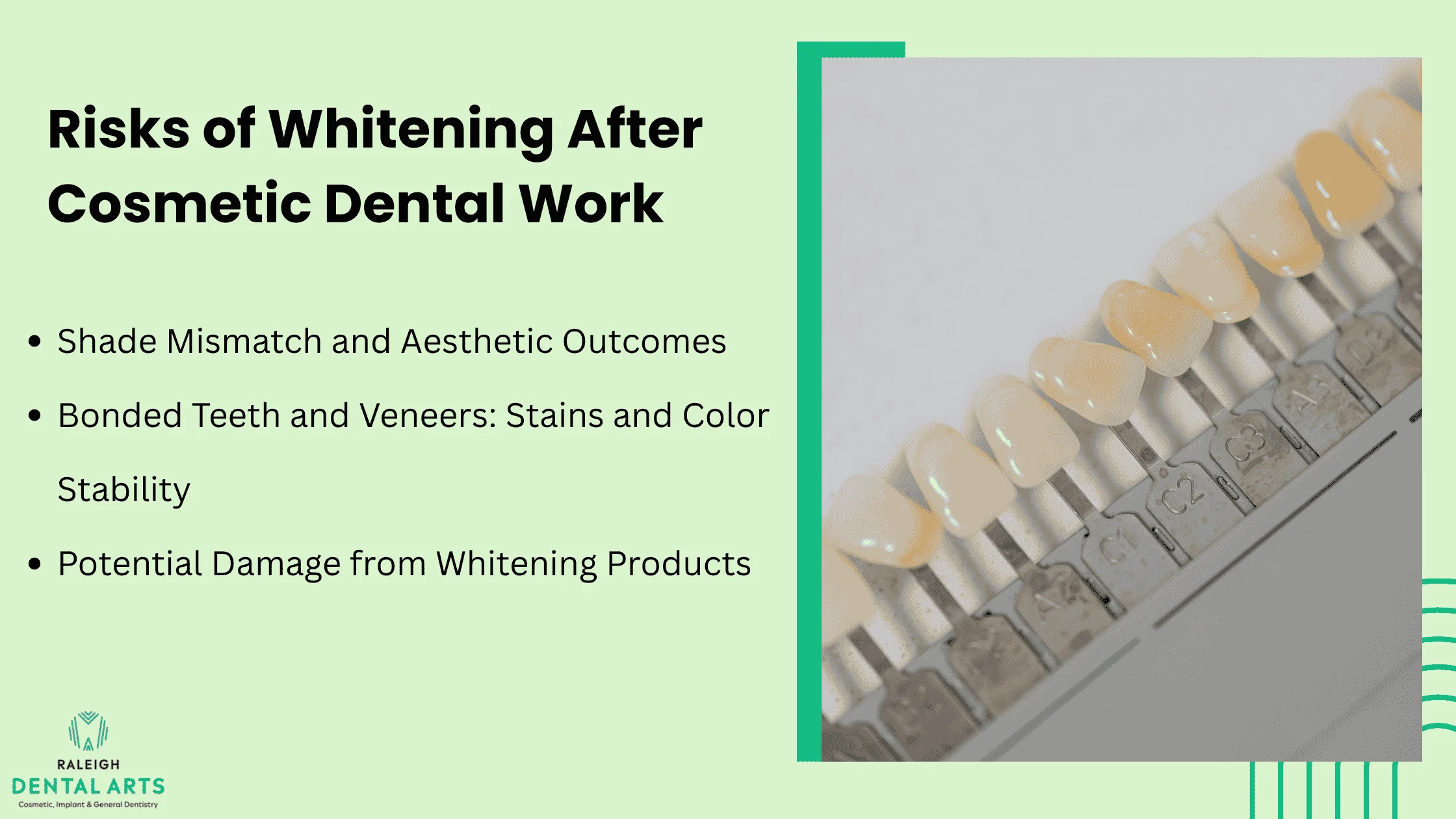 Teeth Whitening After Veneers or Bonding: Safe Options and Pitfalls 1 Challenges and Risks When Whitening After Cosmetic Restorations