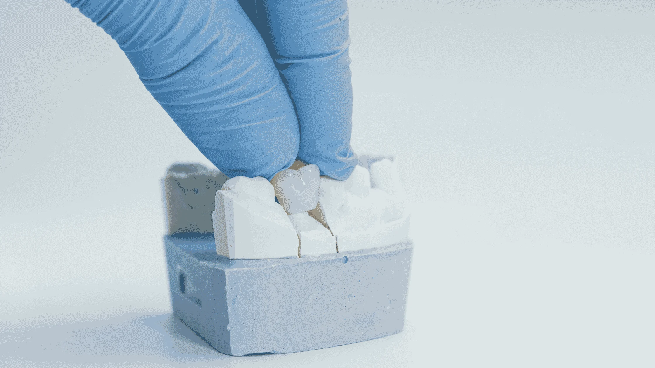 Crowns and Other Restorations