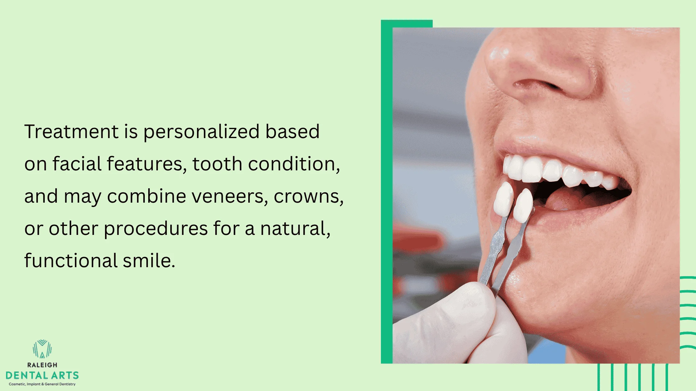 Personalized Smile Design Considerations