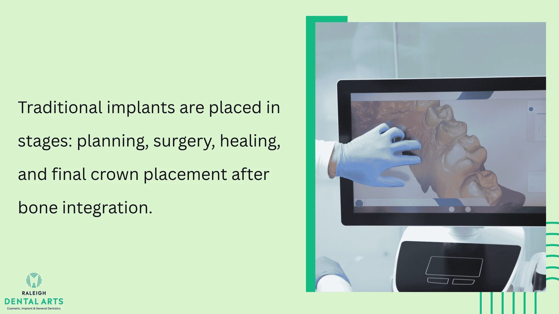 Placement and Surgical Phases