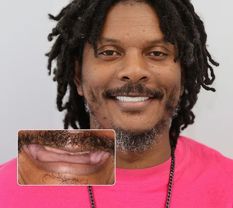 Restore a Strong Natural Smile That Lasts