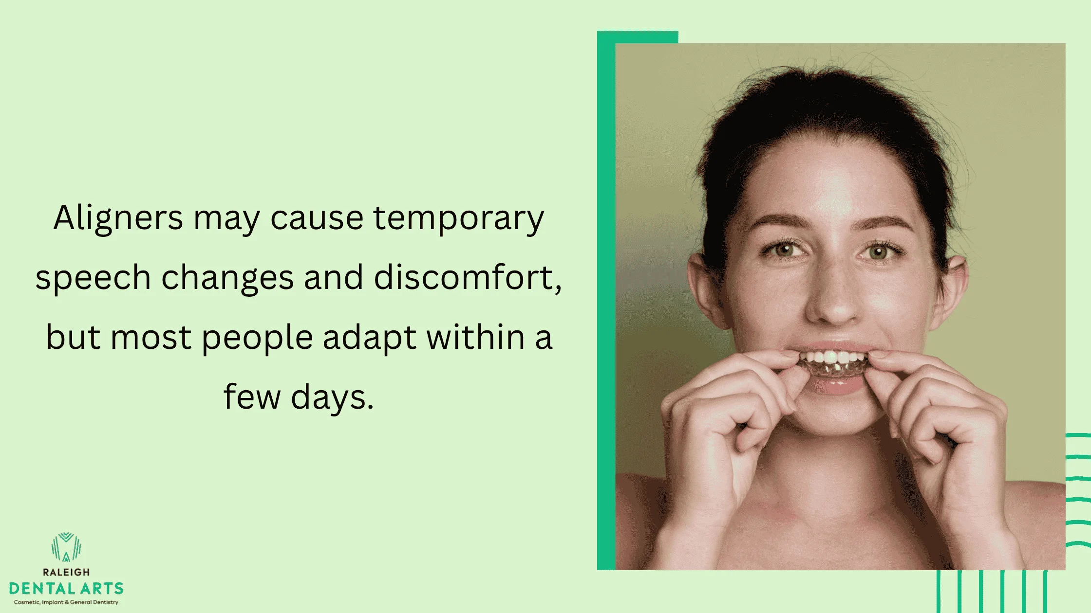 Clear Aligners for Adults: What to Expect in Your First 90 Days 2 Speaking With Aligners and Overcoming Initial Challenges