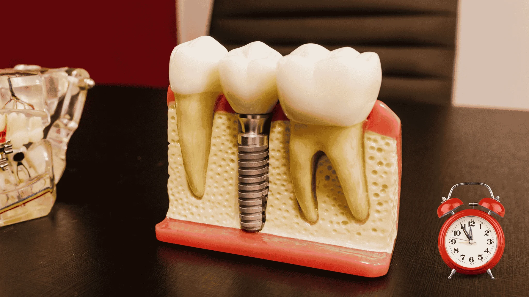 same day implant and extraction