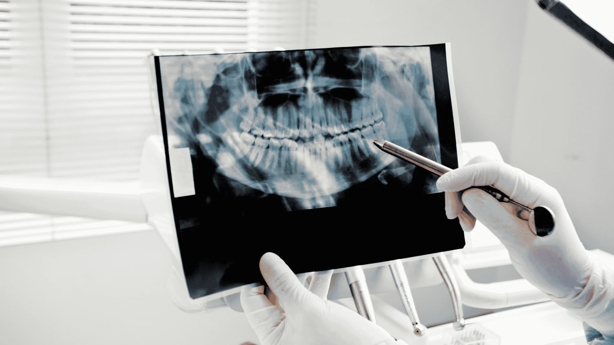 signs of dental implant failure