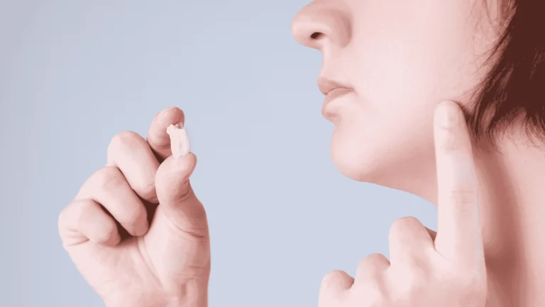 signs you need wisdom teeth removal