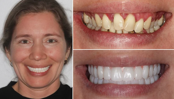 smile gallery img 39