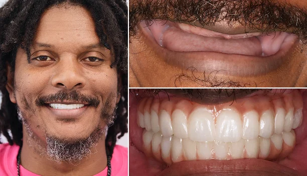 smile gallery img 40