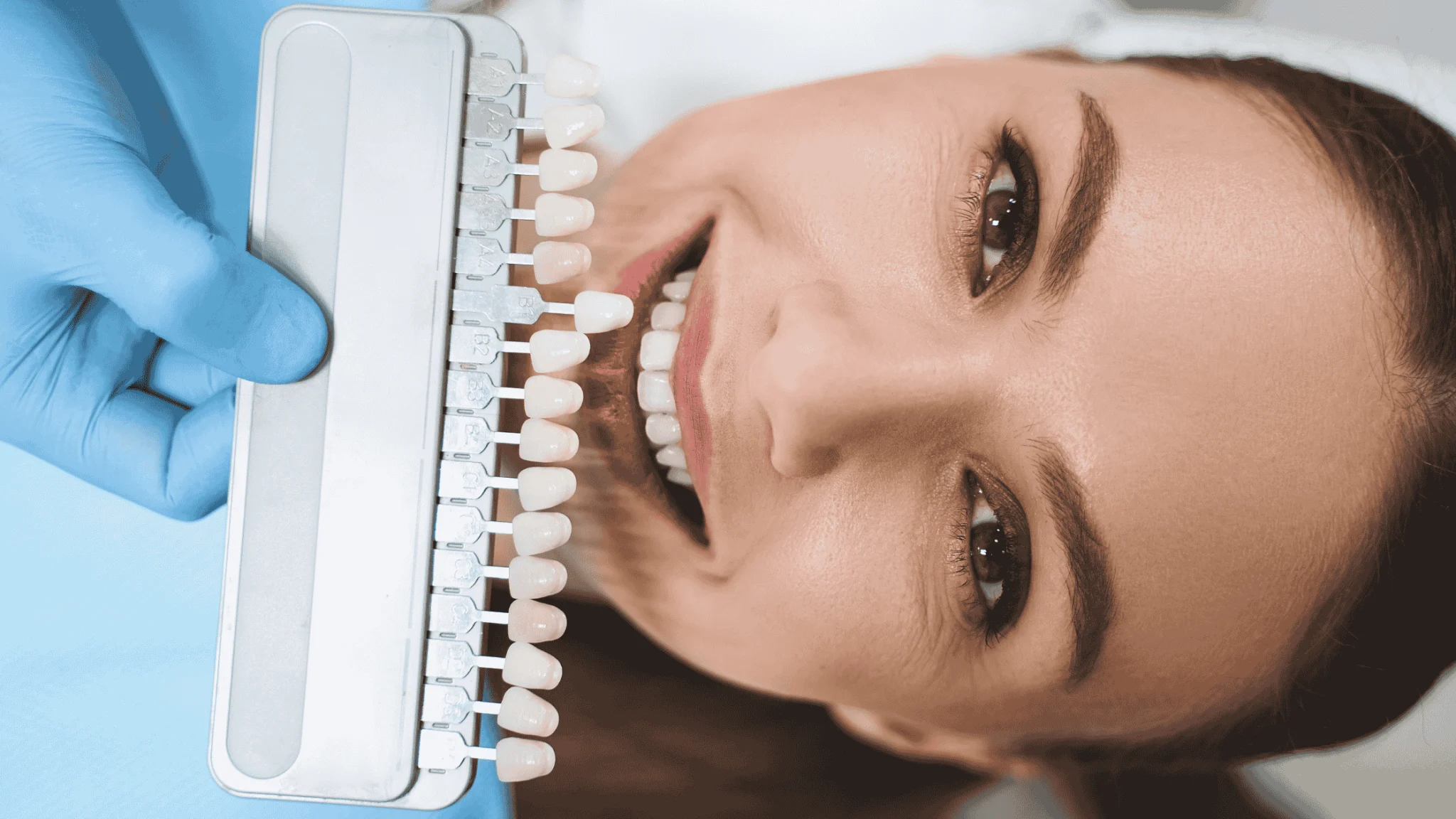 smile makeover vs veneers